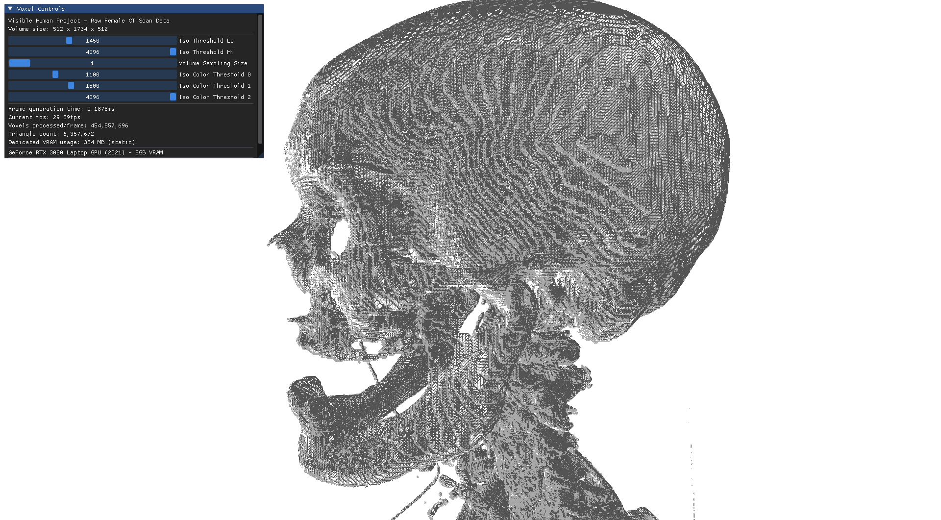 Wireframe skull rendered from VHP CT data
